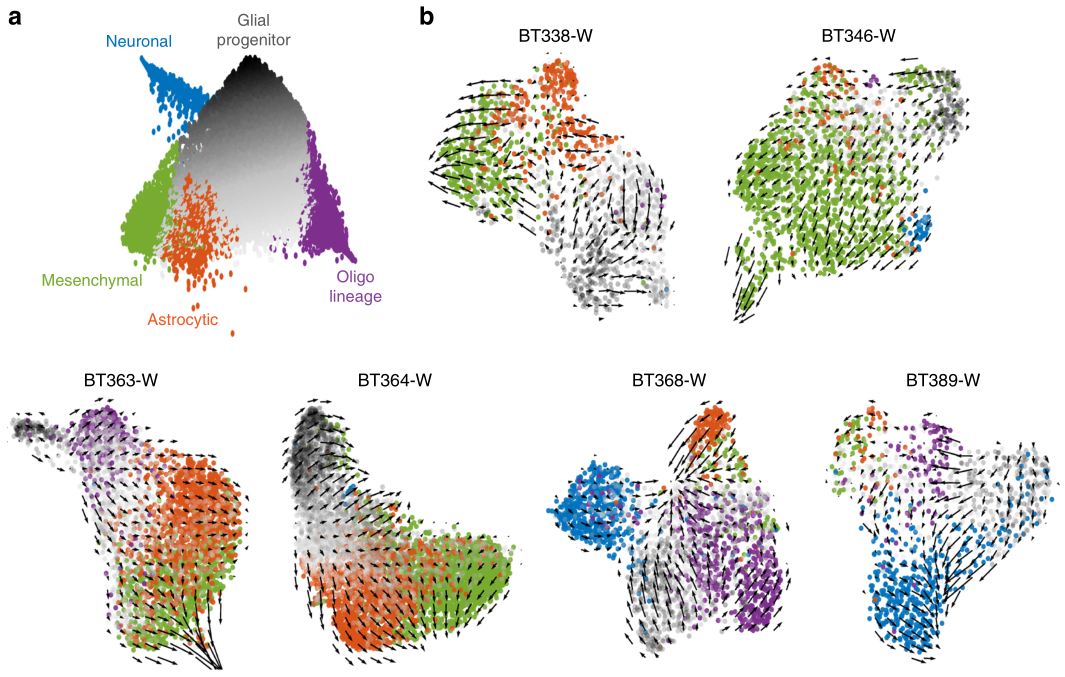 膠質(zhì)母細胞瘤RNA速度分析